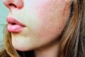Beauty sleep, dormire bene fa davvero bene alla pelle? Cosa dice la scienza
